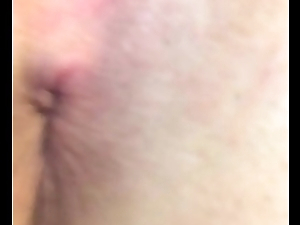 Close up butthole